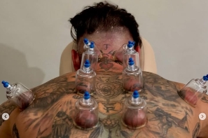 密密麻麻！39岁拉莫斯昨日踢满全场，今日脖子胳膊等多处都在拔罐